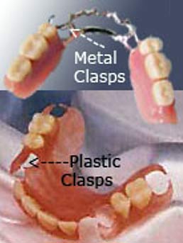 Partial Dentures