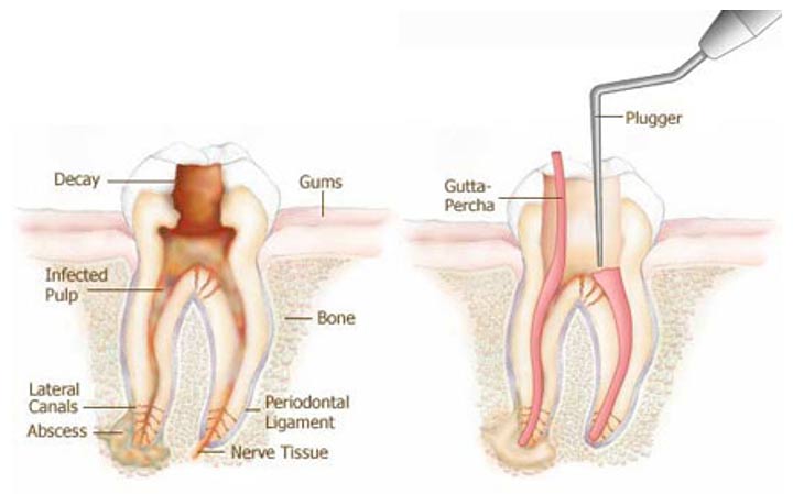 Endodontics